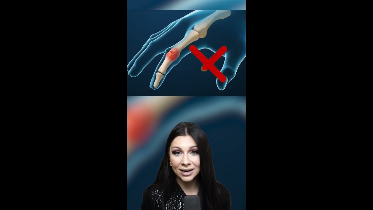 WHAT HAPPENS WHEN YOU CRACK YOUR KNUCKLES