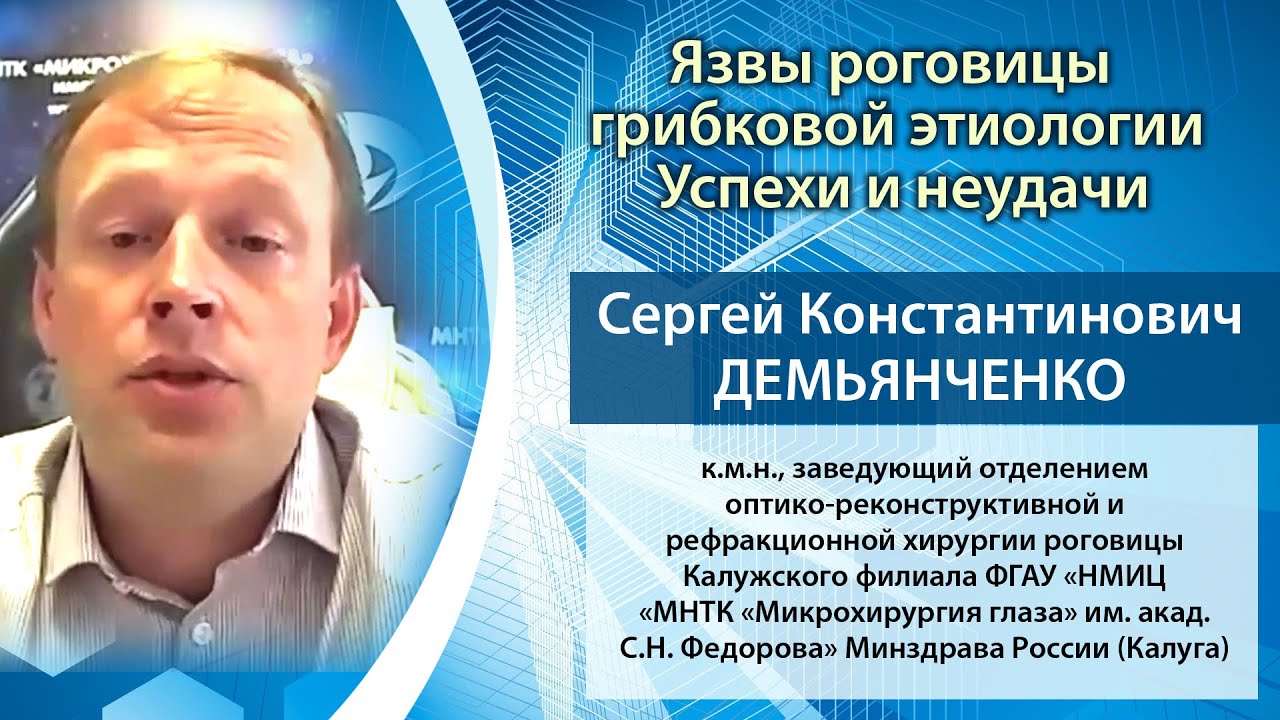 Язвы роговицы грибковой этиологии. Успехи и неудачи