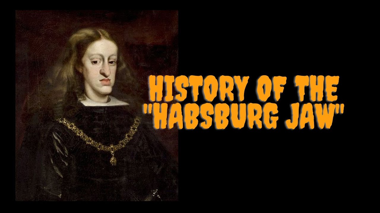 What Is A Habsburg Jaw? A Sign Of Royal Inbreeding Explained