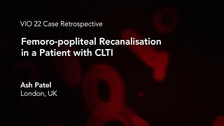 Vascular Interventions Online 2022 Case Retrospective: Femoro-popliteal Recanalisation Case