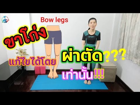 ขาโก่ง แก้ไขได้โดย ผ่าตัด!!! เท่านั้น???