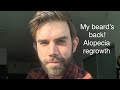 Alopecia Barbae - My beard is back! More thoughts on my AB journey, beard maintenance etc