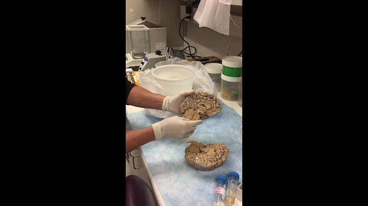 A look at the Brain with Stanford Scientist Lori S...