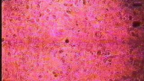 Flow past a confined excentric cylinder and in our cross-slot device