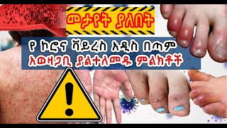 የ ኮሮና ቫይረስ አዲስ በጣም አወዛጋቢ ያልተለመዱ ምልክቶች | New Symptoms Of Novel Corona virus[Covid-19] Ethiopia