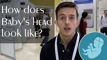 Fetal ultrasound with Machine Learning -- 3D predictions from 2D images before birth