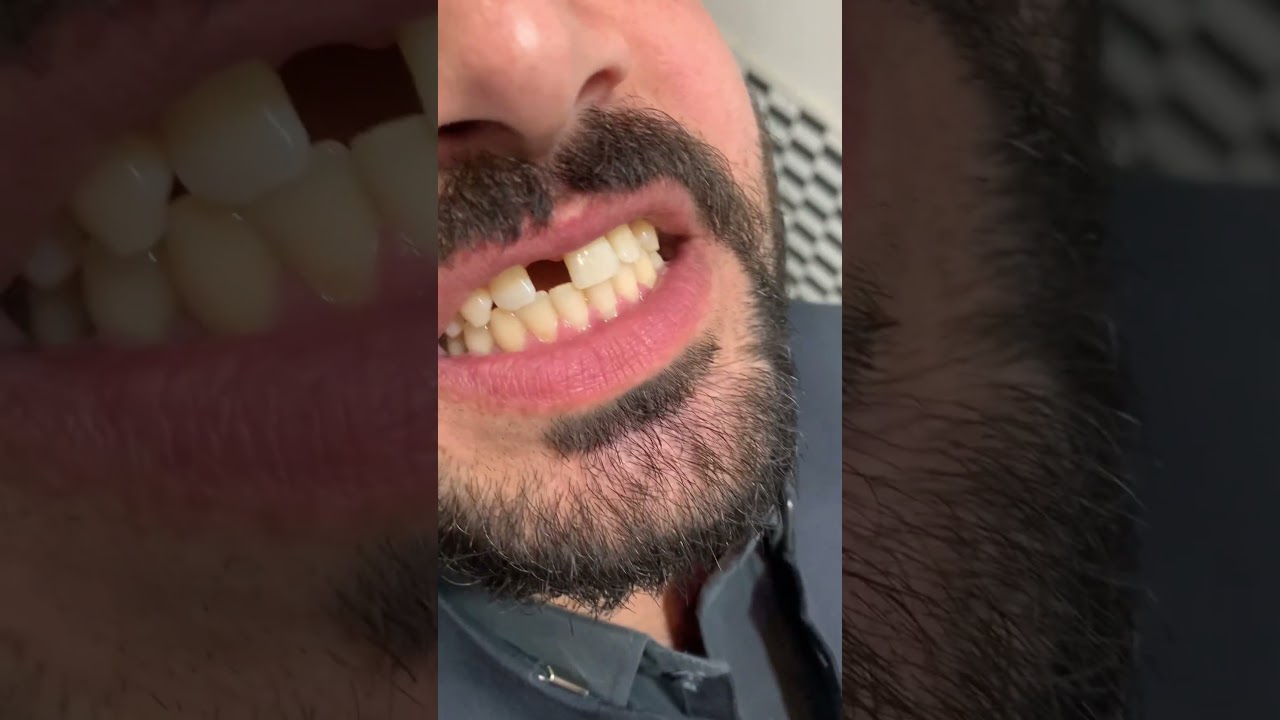 New case starting 👍 