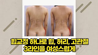힙교정 시리즈4 | 영상으로 보는 블로그 | 닥터 조의 지방흡입에 대한 생각들
