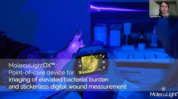 Introduction and Demonstration of the MolecuLightDX Wound Imaging Device