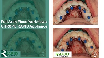 Fixed Full Arch Workflows  - CHROME RAPID Appliance