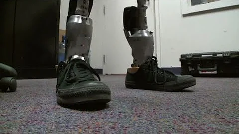 The $50,000 bionic leg