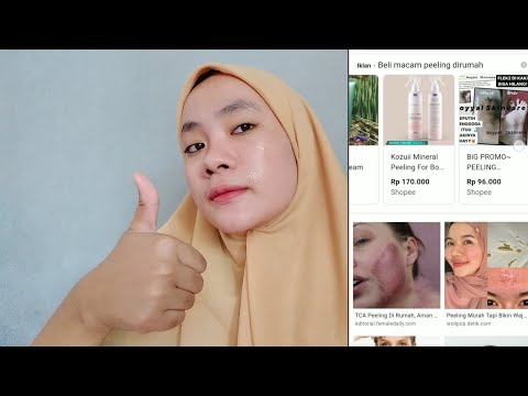 Video: Cara Mengoleskan TCA Peel (dengan Gambar)