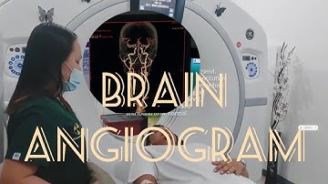 CT Angiography | CT Angiogram of the Brain | CT Scan