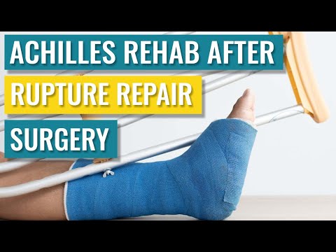 Achilles Rehab after Surgery – Exercises and Recovery Times