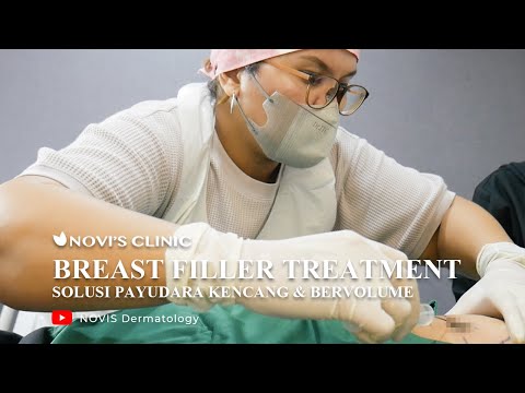 BREAST FILLER SOLUSI PAYUDARA KENCANG & BERVOLUME by dr. Novi Arlisma || NOVI'S Dermatology