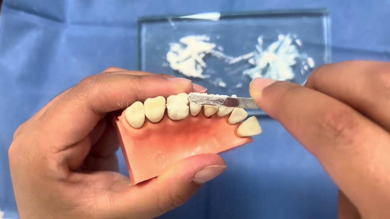 CEMENTO DENTAL 🦷 \\reporte\\