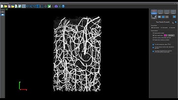 Vesselucida 360: Subvolume Tool