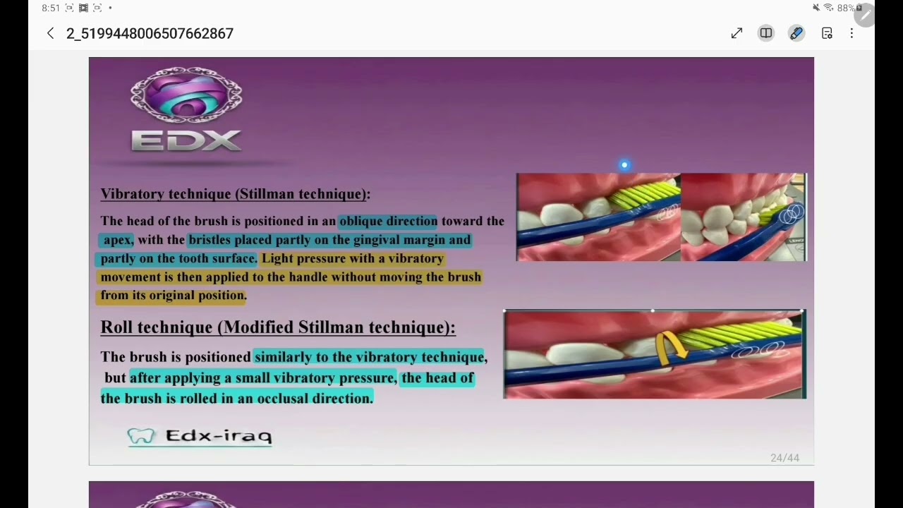Treatment guide lines for patients With periodontal disease (part 2) periodontics بريو مرحلة رابعة  