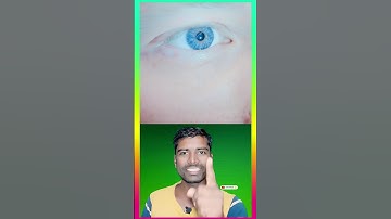 Test your eyes | #iqtest #emojiquizes #puzzle #riddles #paheli #eyes #emojigames #shorts #facts #iq