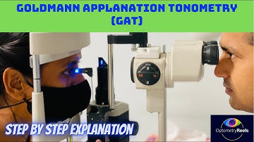 Tonometry || Goldmann Applanation Tonometry || IOP @optometryreels