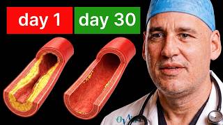 Download Lagu Heart Surgeon: NEW Science To Stop Plaque & Unclog Your Arteries [EAT THIS]