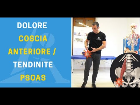 Tendinite PSOAS / dolore ANTERIORE COSCIA: ecco le cause e i rimedi