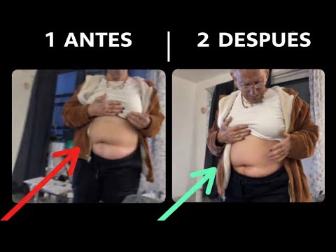 TOTAL HEALING! Woman receives THREE healing miracles 🙏🔥