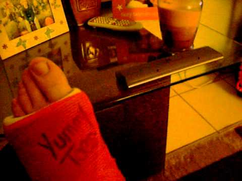 WheelChair BrokenLeg - YouTube
