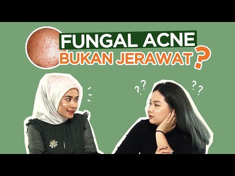 Punya kulit berminyak dan noda bekas jerawat? .... Kamu gak perlu khawatir lagi sekarang dengan miny. 