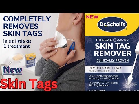 Dr. Scholl's Freeze Away Skin Tag Remover 