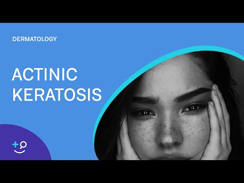 ቪዲዮ: Actinic Keratosis ን ለማከም 3 መንገዶች