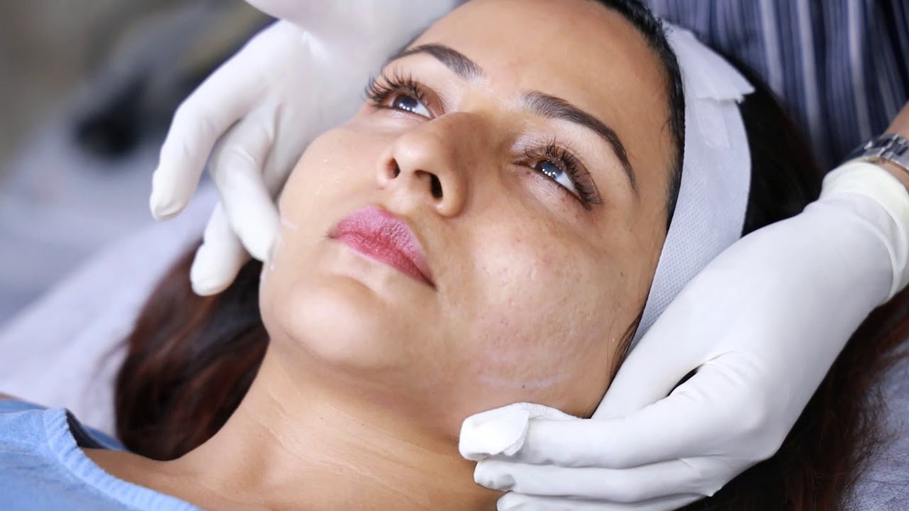 How to get contoured face? Dr. Monica Jacob