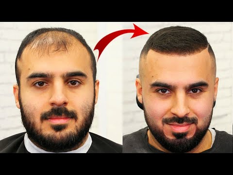 تعليم طريقة اختيار التسريحة المناسبة للشعر الخفيف +بودرة التوباك The only solution for thinning hair