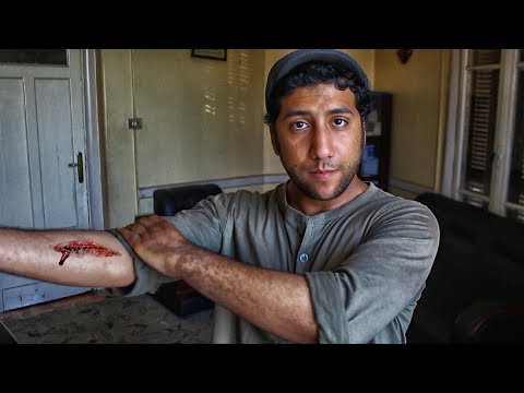 وقف اي نزيف عمر السبتاوى