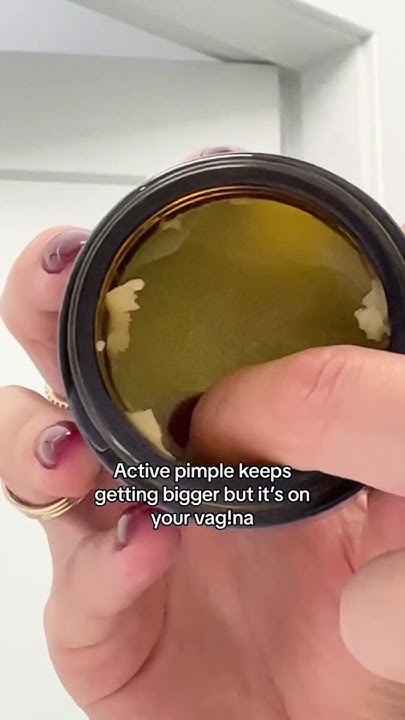 pimples-down-there-youtube