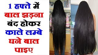 बालों के झड़ने से रोकने के घरेलू सुझाव | How To Stop Hair Fall