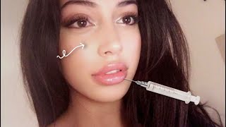 Small Nose, Big Lips