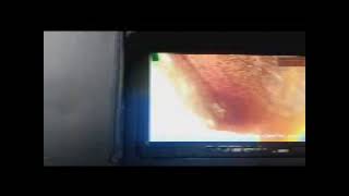 video000000 1
