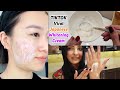 Japanese Secret Whitening Cream at Home 10 Shades to Lighten Skin Remove Dark Spots & Pigmentation