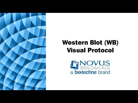 Western Blot (WB) Visual Protocol