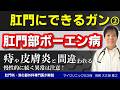 【肛門ボーエン病】湿疹や痔と間違われやすい稀な皮膚がん|早期発見するための症状から治療について肛門専門医が解説します