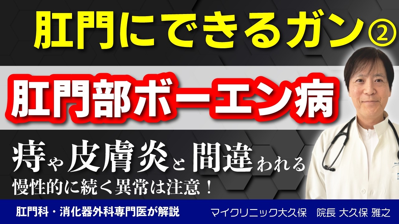【肛門ボーエン病】湿疹や痔と間違われやすい稀な皮膚がん|早期発見するための症状から治療について肛門専門医が解説します