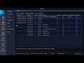 Enable and Disable DHCP on UNV NVR