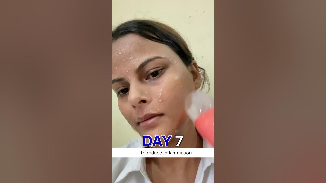 7day ice rubbing on face | Ice for face | face icing benefits #beautytips #ashortaday #skincare 7day ice rubbing on face | Ice for face | face icing benefits #beautytips #ashortaday #skincare