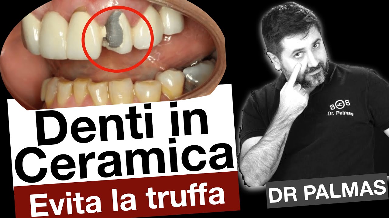Wenko Bicchiere Da Denti Glimma, Ceramica, 8, 5 X 10, 5 Cm, Oro, 8, 5 X 10, 5 X 8, 5 Cm
