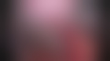 Intra-operative cholangiogram with 5F ureteral catheter