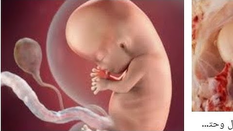 قُتِلَ الْإِنْسَانُ مَا أَكْفَرَهُ (17) مِنْ أَيِّ شَيْءٍ خَلَقَهُ (18) (سورة عبس)🌹🥀🌹