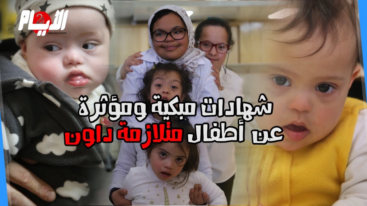 شهادات مبكية ومؤثرة عن أطفال متلازمة داون