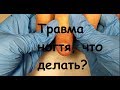 ТРАВМА НОГТЯ!Что делать?весь процесс до и после/слабонервным не смотреть