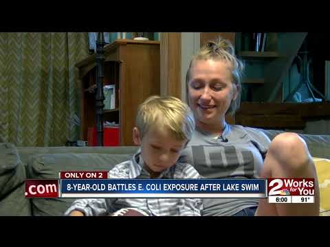 8-year-old battles E. coli exposure after lake swim